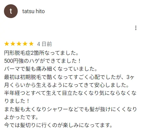 500円玉大のハゲが2つ改善したという方の口コミ